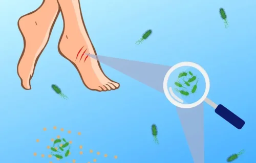 &bdquo;Месоядната&ldquo; бактерия Vibrio настъпва в Европа: какво означава това за Черно море