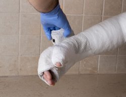 Инцидент в Слънчев бряг: 3-годишно дете е със счупена ръка след игра на батут